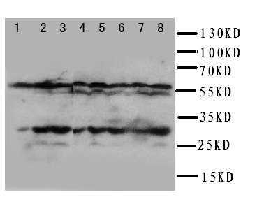 MtTFA / TFAM Antibody - WB of MtTFA / TFAM antibody. Lane 1: HELA Cell Lysate. Lane 2: JURKAT Cell Lysate. Lane 3: 293T Cell Lysate. Lane 4: Rabbit IgG(55kD). Lane 5: A431 Cell Lysate. Lane 6: RAJI Cell Lysate. Lane 7: CEM Cell Lysate. Lane 8: HL-60 Cell Lysate. Lane 9: HUT Cell Lysate.