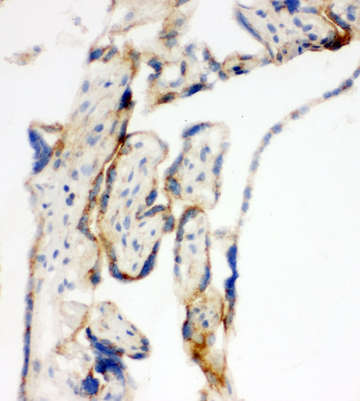 MtTFA / TFAM Antibody - MtTFA / TFAM antibody. IHC(F): Human Placenta Tissue.