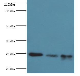 MtTFA / TFAM Antibody - Western blot. All lanes: TFAM antibody at 8 ug/ml. Lane 1: Jurkat whole cell lysate Lane 2: MCF-7 whole cell lysate Lane 3: A431 whole cell lysate. Secondary antibody: goat polyclonal to rabbit at 1:10000 dilution. Predicted band size: 25 kDa. Observed band size: 25 kDa.  This image was taken for the unconjugated form of this product. Other forms have not been tested.