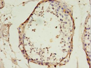 MtTFA / TFAM Antibody - Immunohistochemistry of paraffin-embedded human testis using antibody at 1:100 dilution.  This image was taken for the unconjugated form of this product. Other forms have not been tested.