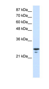 MtTFA / TFAM Antibody - TFAM antibody Western blot of Jurkat lysate. This image was taken for the unconjugated form of this product. Other forms have not been tested.