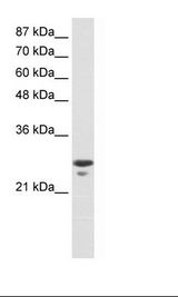 MtTFA / TFAM Antibody - Jurkat Cell Lysate.  This image was taken for the unconjugated form of this product. Other forms have not been tested.