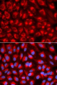 MtTFA / TFAM Antibody - Immunofluorescence analysis of U2OS cells.