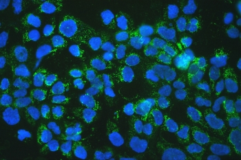 MtTFA / TFAM Antibody - Western blot testing of 1) rat brain, 2) human placenta, 3) human HeLa, 4) mouse HEPA1-6, 5) human HepG2 and 6) human COLO320 with mtTFA antibody. Expected molecular weight 24~29 kDa.