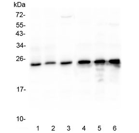 MtTFA / TFAM Antibody - Western blot testing of human 1) Jurkat, 2) A431, 3) HL-60, 4) CCRF-CEM, 5) 293T and 6) SW620 lysate with mtTFA antibody at 0.5ug/ml. Expected molecular weight 24~29 kDa.