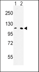 MTTP / MTP Antibody - Western blot of MTTP Antibody in HeLa(lane 1), 293(lane 2) cell line lysates (35 ug/lane). MTTP (arrow) was detected using the purified antibody.