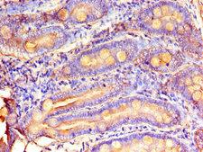 MTTP / MTP Antibody - Immunohistochemistry of paraffin-embedded human small intestine tissue using MTTP Antibody at dilution of 1:100
