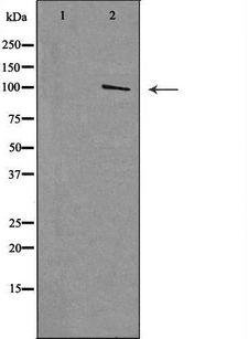 MTTP / MTP Antibody - Western blot analysis of extracts of 293 cells using MTTP antibody. The lane on the left is treated with the antigen-specific peptide.