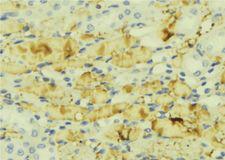 MTTP / MTP Antibody - 1:100 staining mouse liver tissue by IHC-P. The sample was formaldehyde fixed and a heat mediated antigen retrieval step in citrate buffer was performed. The sample was then blocked and incubated with the antibody for 1.5 hours at 22°C. An HRP conjugated goat anti-rabbit antibody was used as the secondary.