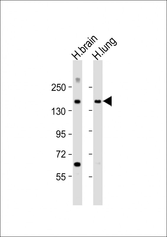 MTUS1 Antibody - All lanes: Anti-MTUS1 Antibody (N-Term) at 1:2000 dilution. Lane 1: human brain lysate. Lane 2: human lung lysate Lysates/proteins at 20 ug per lane. Secondary Goat Anti-Rabbit IgG, (H+L), Peroxidase conjugated at 1:10000 dilution. Predicted band size: 141 kDa. Blocking/Dilution buffer: 5% NFDM/TBST.