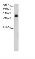 MTUS1 Antibody - Jurkat Cell Lysate.  This image was taken for the unconjugated form of this product. Other forms have not been tested.