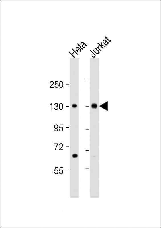 MTUS1 Antibody - All lanes: Anti-MTUS1 Antibody (C-Term) at 1:2000 dilution. Lane 1: HeLa whole cell lysate. Lane 2: Jurkat whole cell lysate Lysates/proteins at 20 ug per lane. Secondary Goat Anti-Rabbit IgG, (H+L), Peroxidase conjugated at 1:10000 dilution. Predicted band size: 141 kDa. Blocking/Dilution buffer: 5% NFDM/TBST.