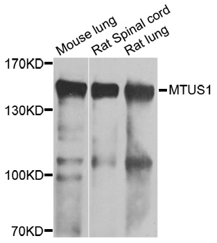 MTUS1 Antibody - Western blot analysis of extracts of various cell lines.
