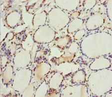 MTUS1 Antibody - Immunohistochemistry of paraffin-embedded human thyroid tissue at dilution 1:100