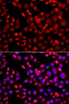 MTUS1 Antibody - Immunofluorescence analysis of A549 cells using MTUS1 Polyclonal Antibody.
