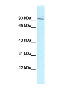 MTUS2 Antibody - MTUS2 / KIAA0774 antibody Western blot of HepG2 Cell lysate. Antibody concentration 1 ug/ml.  This image was taken for the unconjugated form of this product. Other forms have not been tested.