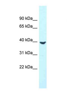 MTUS2 Antibody - MTUS2 / KIAA0774 antibody Western blot of Fetal Liver lysate. Antibody concentration 1 ug/ml.  This image was taken for the unconjugated form of this product. Other forms have not been tested.