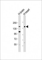 MTUS2 Antibody - All lanes: Anti-MTUS2 Antibody (C-Term) at 1:2000 dilution Lane 1: human brain lysate Lane 2: human heart lysate Lysates/proteins at 20 µg per lane. Secondary Goat Anti-Rabbit IgG, (H+L), Peroxidase conjugated at 1/10000 dilution. Predicted band size: 150 kDa Blocking/Dilution buffer: 5% NFDM/TBST.