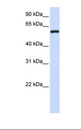 MTX1 / Metaxin 1 Antibody - Fetal brain lysate. Antibody concentration: 1.0 ug/ml. Gel concentration: 12%.  This image was taken for the unconjugated form of this product. Other forms have not been tested.