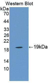 MTX1 / Metaxin 1 Antibody - Western blot of MTX1 / Metaxin 1 antibody.