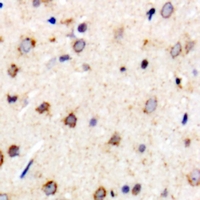 MTX1 / Metaxin 1 Antibody - Immunohistochemical analysis of Metaxin-1 staining in rat brain formalin fixed paraffin embedded tissue section. The section was pre-treated using heat mediated antigen retrieval with sodium citrate buffer (pH 6.0). The section was then incubated with the antibody at room temperature and detected using an HRP conjugated compact polymer system. DAB was used as the chromogen. The section was then counterstained with hematoxylin and mounted with DPX.