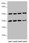 MTX1 / Metaxin 1 Antibody - Western blot All Lanes: MTX1 antibody at 3.78 ug/ml Lane 1: Jurkat whole cell lysate Lane 2: A549 whole cell lysate Lane 3: HepG-2 whole cell lysate Lane 4: MCF7 whole cell lysate Secondary Goat polyclonal to rabbit IgG at 1/10000 dilution Predicted band size: 52,49,36 kDa Observed band size: 51,36 kDa