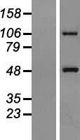 MTX1 / Metaxin 1 Protein - Western validation with an anti-DDK antibody * L: Control HEK293 lysate R: Over-expression lysate