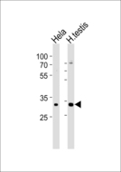 MTX2 Antibody - Western blot of lysates from HeLa cell line human testis tissue lysate (from left to right) with MTX2 Antibody. Antibody was diluted at 1:1000 at each lane. A goat anti-rabbit IgG H&L (HRP) at 1:5000 dilution was used as the secondary antibody. Lysates at 35 ug per lane.