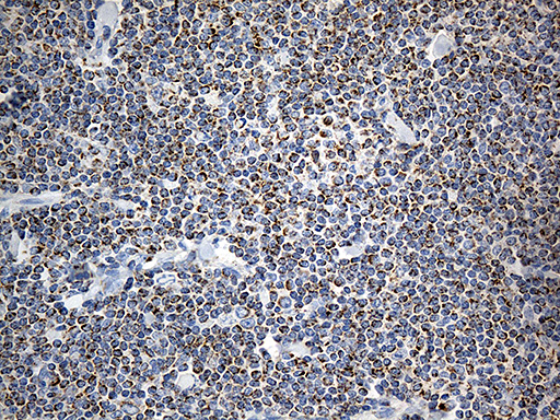 MTX2 Antibody - Immunohistochemical staining of paraffin-embedded Human lymphoma tissue using anti-MTX2 mouse monoclonal antibody. (Heat-induced epitope retrieval by 1mM EDTA in 10mM Tris buffer. (pH8.5) at 120°C for 3 min. (1:500)