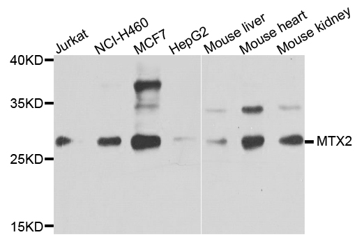 MTX2 Antibody - Western blot analysis of extracts of various cells.