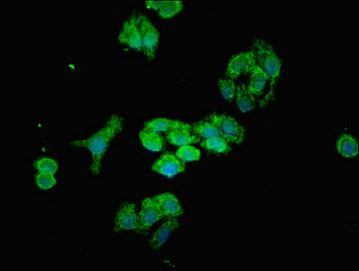 MTX2 Antibody - Immunofluorescent analysis of HepG2 cells diluted at 1:100 and Alexa Fluor 488-congugated AffiniPure Goat Anti-Rabbit IgG(H+L)