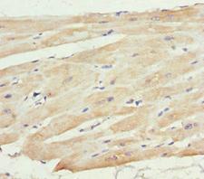 MTX2 Antibody - Immunohistochemistry of paraffin-embedded human heart tissue at dilution 1:100