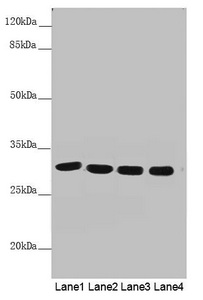 MTX2 Antibody - Western blot All Lanes: MTX2 antibody at 4.53 ug/ml Lane 1: Mouse heart tissue Lane 2: Mouse kidney tissue Lane 3: Jurkat whole cell lysate Lane 4: Mouse liver tissue Secondary Goat polyclonal to rabbit IgG at 1/10000 dilution Predicted band size: 30,29 kDa Observed band size: 30 kDa