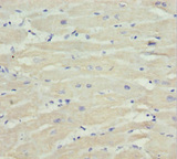 MTX2 Antibody - Immunohistochemistry of paraffin-embedded human heart tissue at dilution 1:100