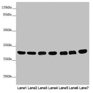 MTX2 Antibody - Western blot All Lanes: MTX2 antibody at 3.79 ug/ml Lane 1: Mouse heart tissue Lane 2: Mouse kidney tissue Lane 3: Mouse liver tissue Lane 4: Jurkat whole cell lysate Lane 5: MCF7 whole cell lysate Lane 6: HepG-2 whole cell lysate Lane 7: 293T whole cell lysate Secondary Goat polyclonal to rabbit IgG at 1/10000 dilution Predicted band size: 30,29 kDa Observed band size: 30 kDa