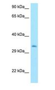 MTX3 Antibody - MTX3 antibody Western Blot of MCF7.  This image was taken for the unconjugated form of this product. Other forms have not been tested.