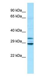 MTX3 Antibody - MTX3 antibody Western Blot of Fetal Heart.  This image was taken for the unconjugated form of this product. Other forms have not been tested.