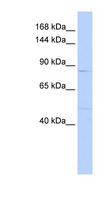 MUC12 Antibody - MUC12 antibody Western blot of MCF7 cell lysate. This image was taken for the unconjugated form of this product. Other forms have not been tested.