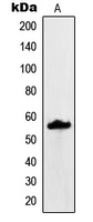 MUC13 Antibody - Western blot analysis of MUC13 expression in KNRK (A) whole cell lysates.