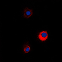 MUC13 Antibody - Immunofluorescent analysis of MUC13 staining in KNRK cells. Formalin-fixed cells were permeabilized with 0.1% Triton X-100 in TBS for 5-10 minutes and blocked with 3% BSA-PBS for 30 minutes at room temperature. Cells were probed with the primary antibody in 3% BSA-PBS and incubated overnight at 4 C in a humidified chamber. Cells were washed with PBST and incubated with a DyLight 594-conjugated secondary antibody (red) in PBS at room temperature in the dark. DAPI was used to stain the cell nuclei (blue).