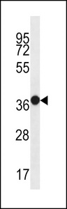 MUC15 Antibody - MUC15 Antibody western blot of WiDr cell line lysates (35 ug/lane). The MUC15 antibody detected the MUC15 protein (arrow).