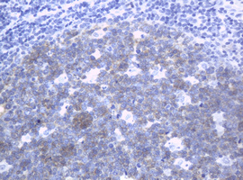 MUC16 / CA125 Antibody - IHC of paraffin-embedded Human tonsil using anti-MUC16 mouse monoclonal antibody. (Heat-induced epitope retrieval by 10mM citric buffer, pH6.0, 120°C for 3min).