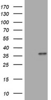 MUC16 / CA125 Antibody - HEK293T cells were transfected with the pCMV6-ENTRY control (Left lane) or pCMV6-ENTRY MUC16 (SC200446, Right lane) cDNA for 48 hrs and lysed. Equivalent amounts of cell lysates (5 ug per lane) were separated by SDS-PAGE and immunoblotted with anti-MUC16.