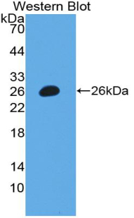 MUC16 / CA125 Antibody - Western blot of recombinant MUC16 / CA125. This image was taken for the unconjugated form of this product. Other forms have not been tested.