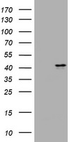 MUC16 / CA125 Antibody - E.coli lysate (left lane) and E.coli lysate expressing Human recombinant protein fragment (right lane) corresponding to amino acids 10329-10628 of human MUC16 (NP_078966) were separated by SDS-PAGE and immunoblotted with anti-MUC16.
