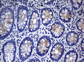 MUC16 / CA125 Antibody - IHC of paraffin-embedded Human colon tissue using anti-MUC16 mouse monoclonal antibody.