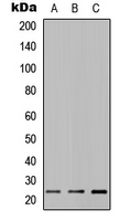 MUC16 / CA125 Antibody - Western blot analysis of MUC16 expression in MCF7 (A); H9C2 (B); PC12 (C) whole cell lysates.