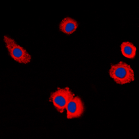 MUC16 / CA125 Antibody - Immunofluorescent analysis of MUC16 staining in HUVEC cells. Formalin-fixed cells were permeabilized with 0.1% Triton X-100 in TBS for 5-10 minutes and blocked with 3% BSA-PBS for 30 minutes at room temperature. Cells were probed with the primary antibody in 3% BSA-PBS and incubated overnight at 4 deg C in a humidified chamber. Cells were washed with PBST and incubated with a DyLight 594-conjugated secondary antibody (red) in PBS at room temperature in the dark. DAPI was used to stain the cell nuclei (blue).