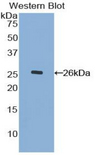 MUC17 Antibody - Western blot of recombinant MUC17.  This image was taken for the unconjugated form of this product. Other forms have not been tested.