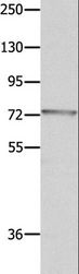 MUC20 Antibody - Western blot analysis of Mouse eye tissue, using MUC20 Polyclonal Antibody at dilution of 1:1400.